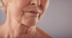Ältere Frau mit deutlichen Falten im Mundbereich